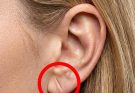 Home » If this sign appears in your ear, it is a warning sign that you have ca… If this sign appears in your ear, it is a warning sign that you have ca…